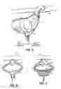 Fig. 09 - Methods and systems for counterpulsation of blood flow to and from the circulatory system