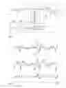 Fig. 07 - Detecting pressure pulses in a blood processing apparatus