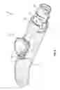 Fig. 06 - Methods for implanting subcutaneous vascular access ports