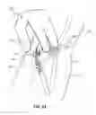 Fig. 07 - Methods for implanting subcutaneous vascular access ports