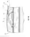 Fig. 22 - Methods for implanting subcutaneous vascular access ports