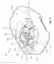 Fig. 30 - Methods for implanting subcutaneous vascular access ports