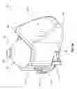 Fig. 43 - Methods for implanting subcutaneous vascular access ports