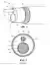 Fig. 02 - Multi-lumen device with non collapsable minor lumen