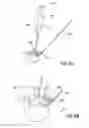 Fig. 06 - Devices and methods for treating tissue