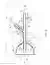 Fig. 03 - Catheter guide and method for utilizing the same