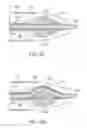 Fig. 09 - Control module for delivery systems