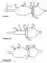 Fig. 02 - Post dilation balloon with marker bands for use with stented valves