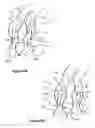 Fig. 04 - Post dilation balloon with marker bands for use with stented valves