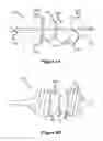 Fig. 07 - Post dilation balloon with marker bands for use with stented valves