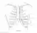 Fig. 02 - Implantable medical devices, systems and components thereof