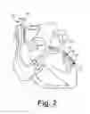 Fig. 03 - Active fixation medical electrical lead