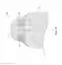Fig. 09 - Leadless cardiac pacemaker with retrieval features