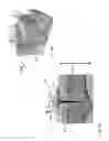 Fig. 06 - Apparatus for neurostimulation