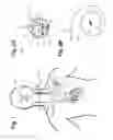 Fig. 02 - Dynamic stimulation adjustment for identification of a neural fulcrum