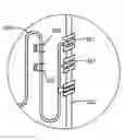 Fig. 01 - Pacemaker for unilateral vocal cord autoparalysis