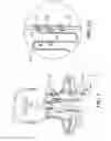 Fig. 04 - Pacemaker for unilateral vocal cord autoparalysis