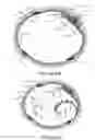Fig. 06 - Transvascular nerve stimulation apparatus and methods
