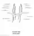 Fig. 15 - Transvascular nerve stimulation apparatus and methods