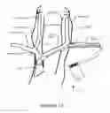 Fig. 16 - Transvascular nerve stimulation apparatus and methods