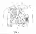 Fig. 02 - Therapy delivery methods and circuits for an implantable medical device