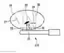 Fig. 01 - Assisting apparatus for assisting in performing a brachytherapy