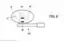 Fig. 06 - Assisting apparatus for assisting in performing a brachytherapy