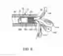 Fig. 07 - Multipurpose Grip and Method of Making Same