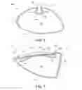 Fig. 06 - Golf club with adjustable weight assembly