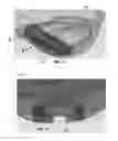 Fig. 09 - Golf club head with internal cap