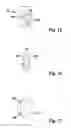 Fig. 08 - Shaft for rotationally coupling a main device to a tubular device