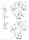 Fig. 13 - Multi-function tool system