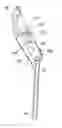 Fig. 01 - Headrest having a recess on a bottom thereof and facing the head of a headrest guide