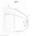 Fig. 02 - Flexible interior mount fascia bracket