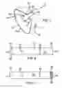 Fig. 02 - Equine Side Protective Device
