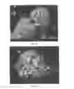 Fig. 07 - METHODS AND COMPOSITIONS USING CALCIUM CARBONATE