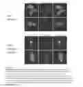 Fig. 10 - Methods and compositions for inhibiting CNKSR1