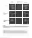 Fig. 12 - Methods and compositions for inhibiting CNKSR1