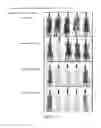 Fig. 27 - COMPOSITIONS AND METHODS FOR THE TREATMENT OF BRAIN CANCERS