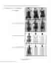 Fig. 29 - COMPOSITIONS AND METHODS FOR THE TREATMENT OF BRAIN CANCERS