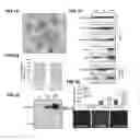 Fig. 02 - Compositions and methods for the display of proteins on the surface of bacteria and their derived vesicles and uses thereof