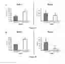 Fig. 05 - METHODS AND PHARMACEUTICAL COMPOSITIONS FOR THE TREATMENT OF BONE METASTASES