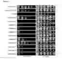 Fig. 02 - IDENTIFICATION OF THERMOTOLERANCE GENES IN YEAST