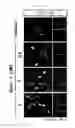 Fig. 22 - Composition for Promoting Differentiation and Proliferation of Neural Stem Cell and Neural Precursor Cell