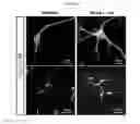 Fig. 28 - Composition for Promoting Differentiation and Proliferation of Neural Stem Cell and Neural Precursor Cell