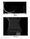 Fig. 06 - Fibres Based on Hydrophobized Derivatives of Hyaluronan, Method of Their Preparation and Use, Textiles on Base Thereof and Use Thereof