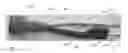 Fig. 01 - Interchangeable knitting needle system