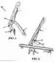 Fig. 04 - Flush lock for casement window and method of operating the same