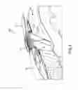 Fig. 05 - System and apparatus for a thrust reverser