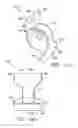 Fig. 11 - Spacer assembly for a bearing